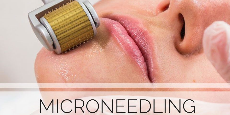 میکرونیدلینگ